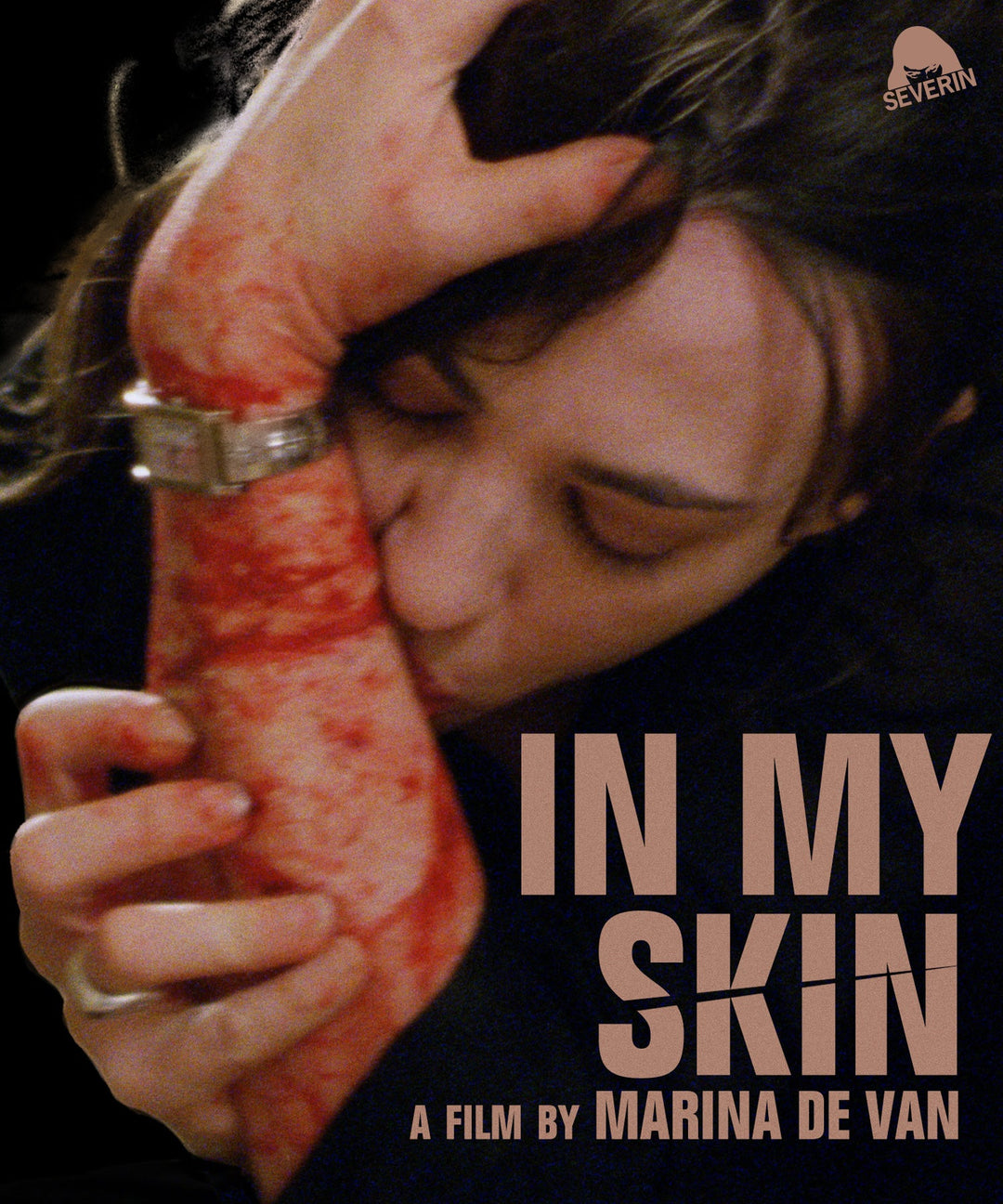 In My Skin